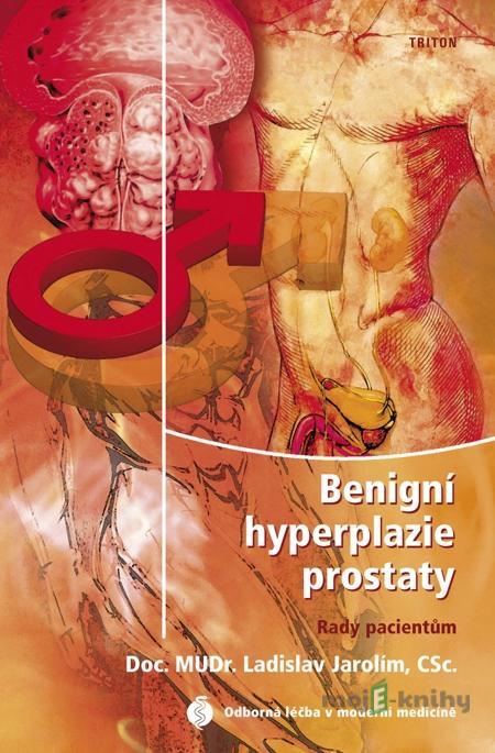 Benigní hyperplazie prostaty - rady pacientům - Ladislav Jarolím Benigní hyperplazie prostaty - rady pacientům - Ladislav Jarolím