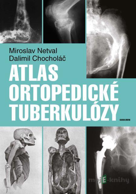Atlas ortopedické tuberkulózy - Dalimil Chocholáč, Miroslav Netval Atlas ortopedické tuberkulózy - Dalimil Chocholáč, Miroslav Netval