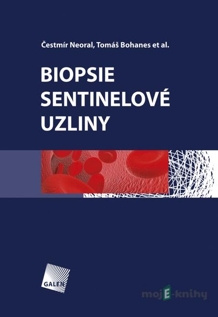 Biopsie sentinelové uzliny - Čestmír Neoral, Tomáš Bohanes a kol. Biopsie sentinelové uzliny - Čestmír Neoral, Tomáš Bohanes a kol.