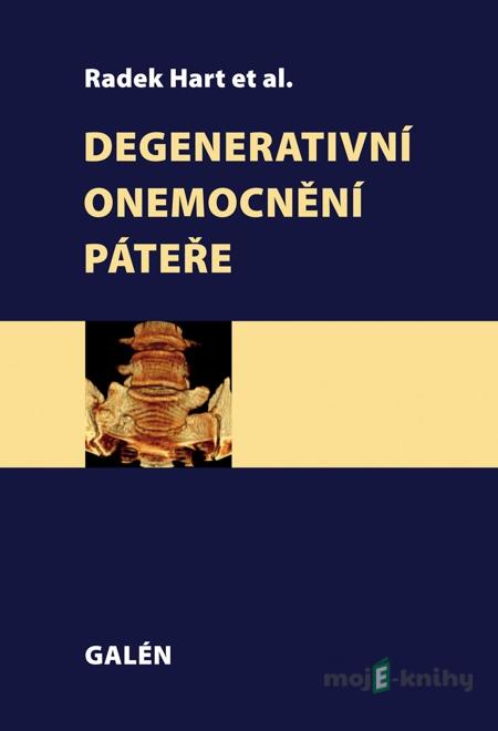 Degenerativní onemocnění páteře - Radek Hart a kolektív Degenerativní onemocnění páteře - Radek Hart a kolektív