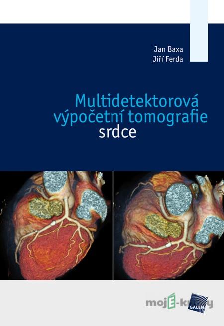 Multidetektorová výpočetní tomografie srdce - Jiří Ferda Multidetektorová výpočetní tomografie srdce - Jiří Ferda