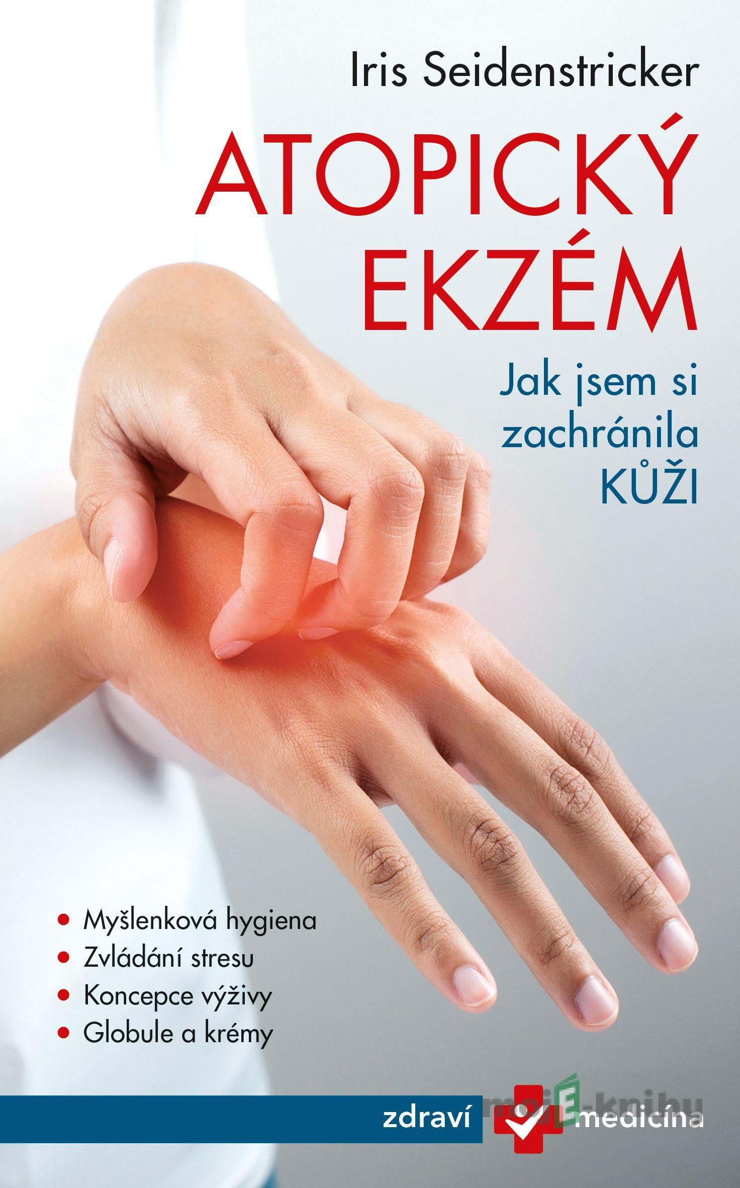 Atopický ekzém - Jak jsem si zachránila kůži - Iris Seidenstricker Atopický ekzém - Jak jsem si zachránila kůži - Iris Seidenstricker