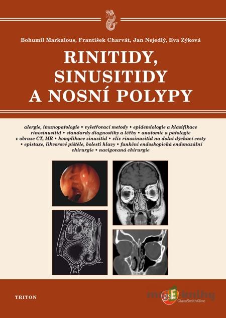 Rinitidy, sinusitidy a nosní polypy - Bohumil Markalous, František Charvát, Jan Nejedlý, Eva Zýková Rinitidy, sinusitidy a nosní polypy - Bohumil Markalous, František Charvát, Jan Nejedlý, Eva Zýková